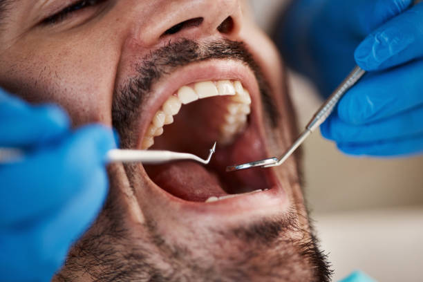 Best Urgent Care for Lost Fillings or Crowns in Mooreville, MS
