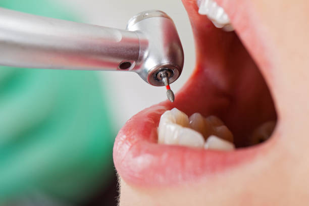 Best Emergency Denture Repair in Mooreville, MS